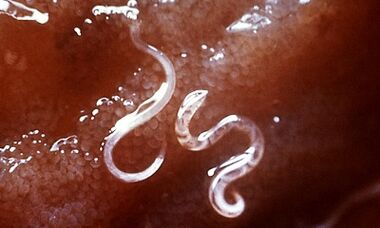 What parasites in the liver are in humans
