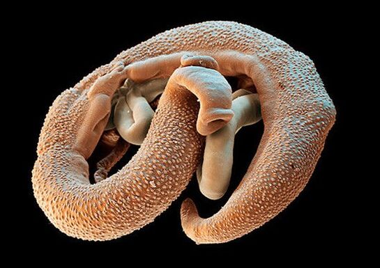 Schistosoma