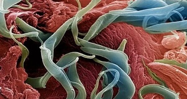 Worms in the human body